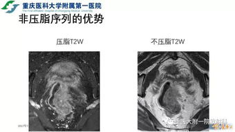 MRI币有希望吗