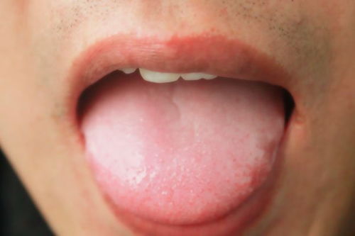 看舌头或许就能知道 若没有3种异常,心脏还很健康