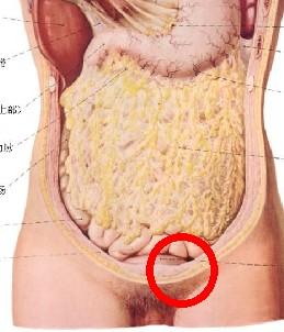 腹部出现了一条状肿块，这为什么会这样子的(腹部有长条状凸起)