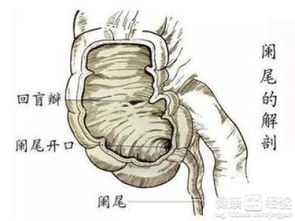 吃什么中药治疗慢性阑尾炎