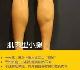 美莱教你小腿粗如何快速变细