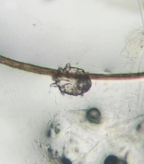 我家狗狗最近一直挠耳朵,宠物医生在显微镜下发现了这种螨虫