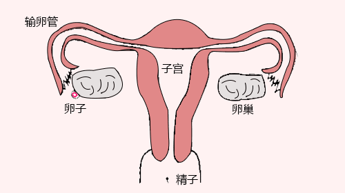 如何修复输卵管损伤能够正常怀孕？
