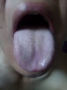 舌头每天都有白白的一层,早上嘴巴里都会有口水在嘴里,吐出来是白的 