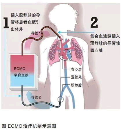 武汉抗击疫情的一线传来好消息