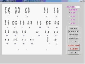 上海欣谕染色体分析系统XY RS A