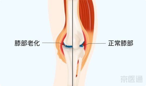 它比跑步更伤膝盖,1 个动作 延长膝盖寿命 ,在家就能做