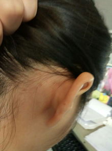 我耳朵后面跟脖子长了一小点一小点的肉粒,会痒,好像还会扩散,这是什么 