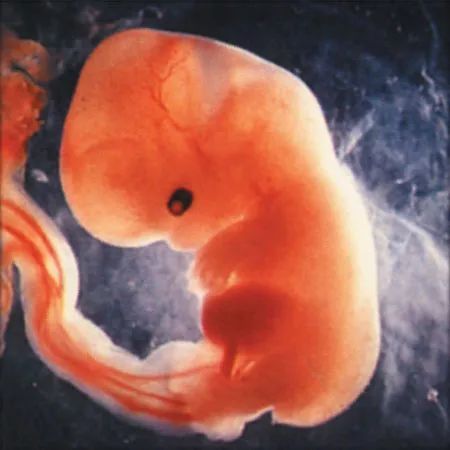 三个月胎儿(怀孕三个月婴儿是什么样子的)