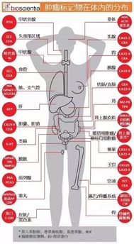 大同防癌筛查,肿瘤标志物升高是不是一定就有肿瘤