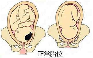 孕晚期,胎儿多少周入盆比较好 一般在这个时间,其中有你吗