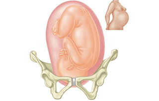 胎儿入盆图(入盆的表现都有哪些)