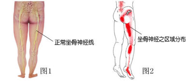 腰部疼痛的原因(男性左侧腰部疼痛的原因)