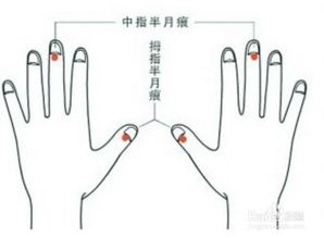 手指上的月牙痕代表什么 