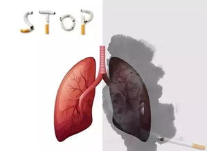 是不抽烟就不会得肺癌吗 听听专家怎么说
