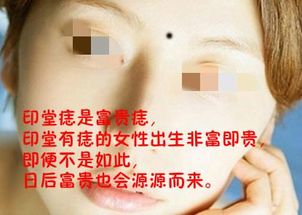 女人身上哪里长痣最好 看你身上有没有