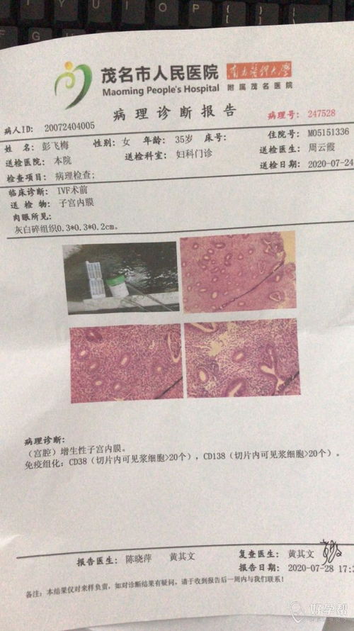 36岁备孕10年目前正在做试管第一次移植失败