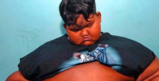 10岁小男孩身患怪病,体重达到了380斤,一天吃十顿