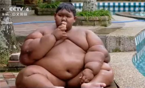世界最胖男孩减重200斤 5年努力 前后对比惊人 