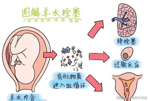 为了给丈夫生个儿子冒险生三胎,好想骂醒那些搏命生孩子的女人