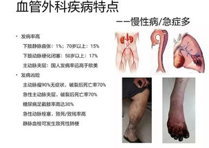 什么是血管外科 看啥病 看完你就明白了