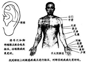 治疗颈椎病高手在民间 