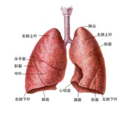 患有肺气肿会得肺癌吗