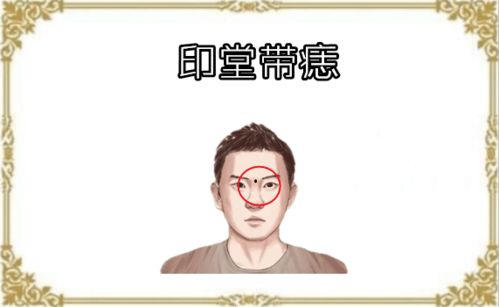 脸上此处一有疤,家里积蓄全败光 ,四种没有出息的男人相