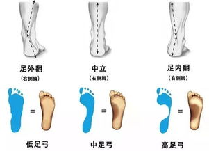 选错跑鞋,你可能会越跑越伤