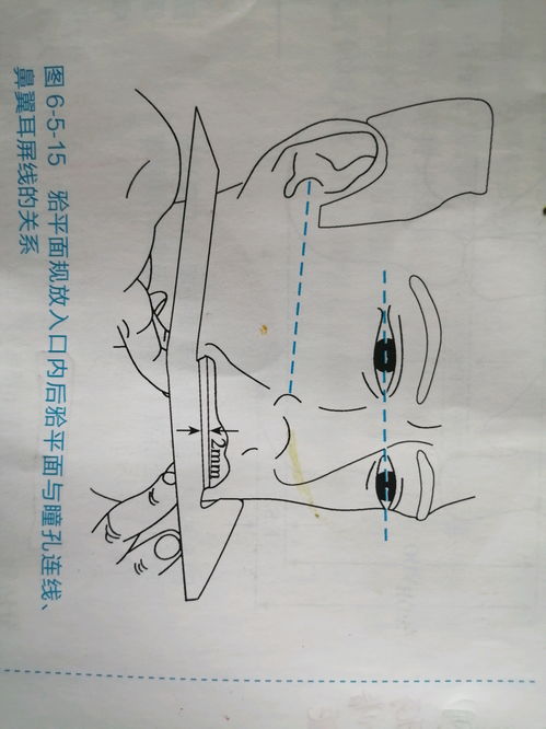 全口义齿修复 颌位关系记录与转移