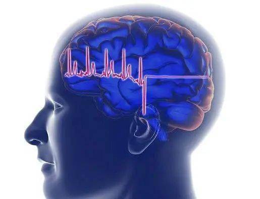 欲知癫痫预后情况如何 且看本文一一道来
