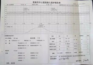 胎心监护怎么才能一次性通过呢 