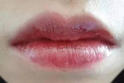 正常人的嘴唇是什么颜色的 