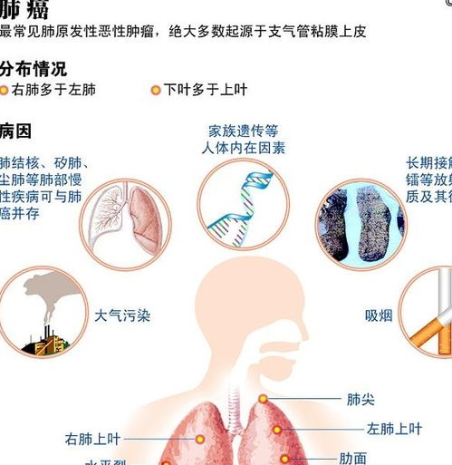 查出腺型肺癌晚期,已扩散到淋巴,不想做化疗应该怎么办