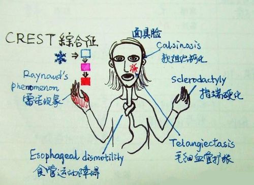 医学生笔记的差距到底有多大,写实派和印象派大比拼,谁更胜一筹