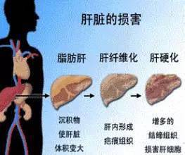 养肝正是时候