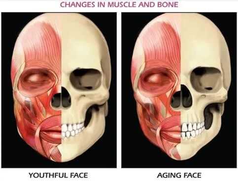 脸的老化松弛下垂,不只是因为胶原蛋白,还有骨骼肌肉以及...