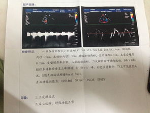 每次去体检都会被医生讲心脏有杂音,去做的彩超,医生都说没有问题 但最近有喘不过气 