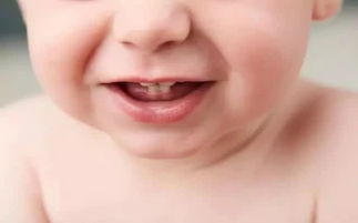 宝宝蛀牙好痛苦,牙齿健康不能少,宝妈要重视宝宝牙齿问题 