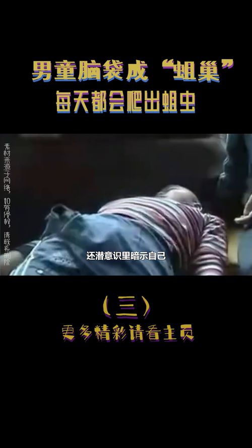 男童脑袋成 蛆巢 ,每天都会爬出蛆虫,村民凑近一看直接吐了 3 