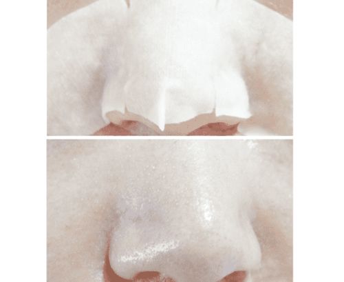 holika猪鼻贴使用方法 正确使用猪鼻贴消除可恨的黑头君