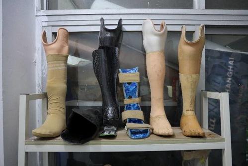 防治麻风病日特写 华哥二十年制作假肢 为千人找到生命肢点