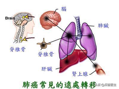 什么是癌,癌为什么会致死