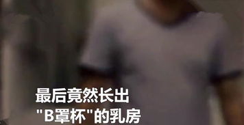 男子胸部过分发育,不输女性,夏天不敢去游泳,背后原因令人无语