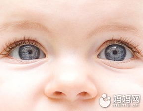 宝宝斗鸡眼怎么办 新生BB眼睛护理全攻略