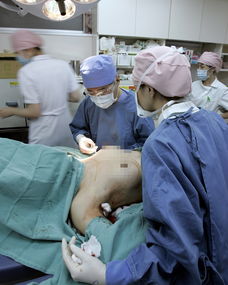 日本硅胶隆胸手术直击 耗时仅1小时 