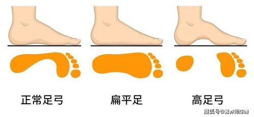 女人衰老从脚开始,如果你脚上有这些特征,衰老开始了