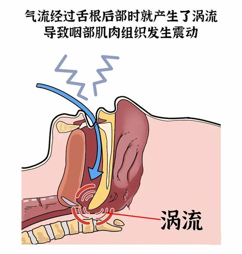 睡眠质量很差 经常做梦 打呼 磨牙,甚至鬼压床及梦游