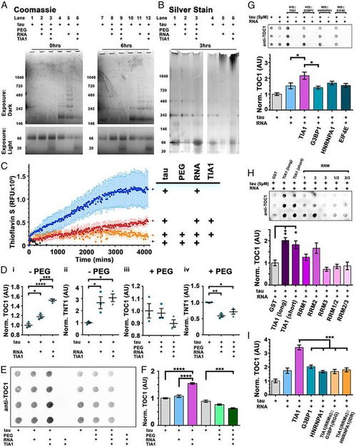 Cell 人类病理性Tau蛋白的翻译后修饰图谱可区分阿尔兹海默症的临床阶段