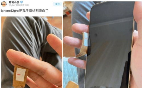 众多网友手被割流血 iPhone 12直角边框太凌厉